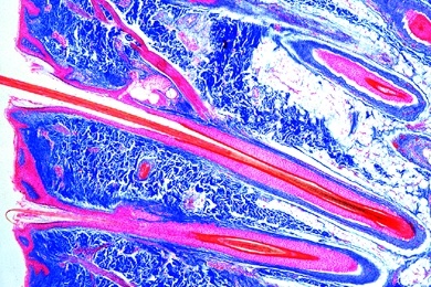 Mikropräparat - Kopfhaut des Menschen quer, (vertikal), Haarwurzeln längs, Talgdrüsen, Keimschichten etc.