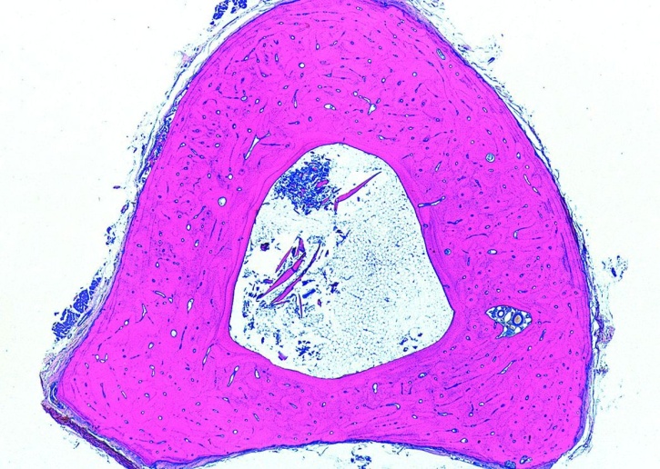 Mikropräparat - Röhrenknochen, quer und längs
