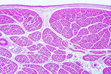 Mikropräparat - Quergestreifte Muskeln (Skelettmuskulatur), Mensch, quer