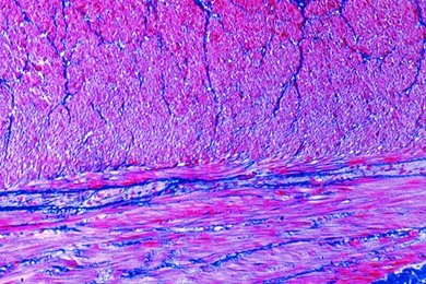 Mikropräparat - Glatte Muskulatur, Mensch, quer und längs