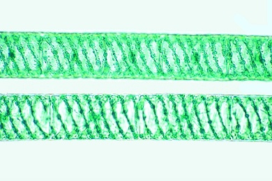 Mikropräparat - Spirogyra, Schraubenalge, mit spiralförmigem Chloroplast