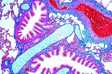 Mikropräparat - Lunge des Menschen, quer, Alveolen, Bronchiolen, Gefäße, Pleura Mikropräparat - Lunge des Menschen, quer, Alveolen, Bronchiolen, Gefäße, Pleura