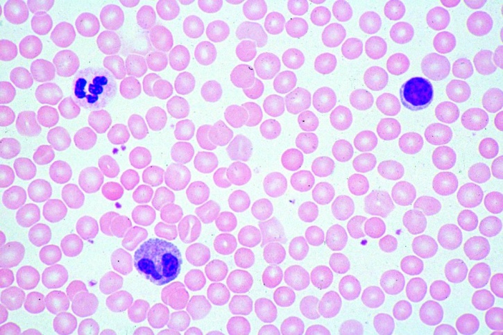 Mikropräparat - Blut des Menschen, Ausstrich, Giemsafärbung zur differenzierten, Darstellung Mikropräparat - Blut des Menschen, Ausstrich, Giemsafärbung zur differenzierten, Darstellung