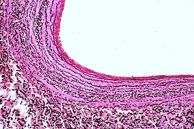 Mikropräparat - Vene des Menschen, quer, Färbung der elastischen Substanz Mikropräparat - Vene des Menschen, quer, Färbung der elastischen Substanz