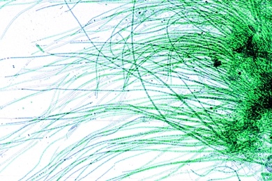 Mikropräparat - Rivularia, Kalkkrusten-Blaualge