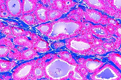 Mikropräparat - Schilddrüse (Gl, thyreoidea), quer