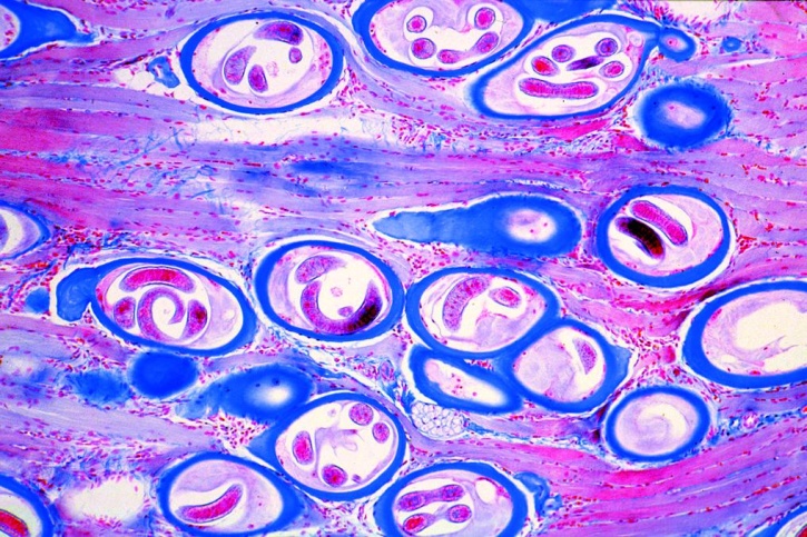 Mikropräparate in Serie - Verschiedene Larvenformen, 10 Präparate
