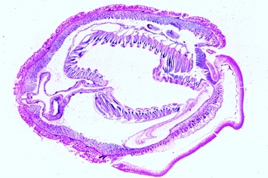 Mikropräparat - Eichelwurm, Balanoglossus, Gonadenregion, quer