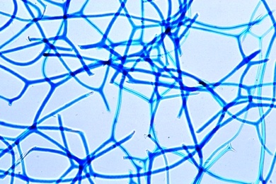 Mikropräparat - Euspongia, Badeschwamm, Schnitt mit Geißelkammern und Skelettelementen. Hornschwamm