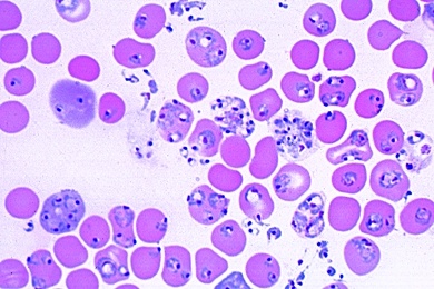 Mikropräparat - Plasmodium berghei, Malaria bei Nagetieren, Blutausstrich mit vegetativen Formen, Schizonten, Merozoiten, Gamonten