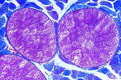 Mikropräparat - Sarcocystis sp,, Schnitt durch infiziertes Muskelgewebe, Mieschersche Schläuche