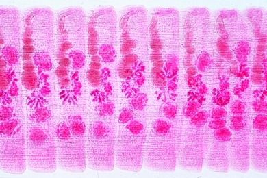 Mikropräparat - Hymenolepis sp., Zwergbandwurm, Proglottiden total