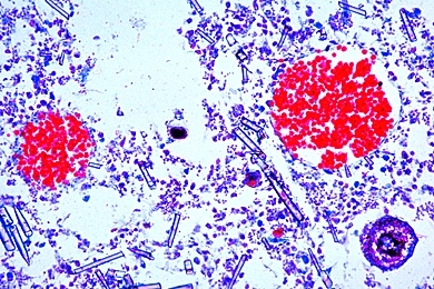 Mikropräparat - Spongilla, Gemmulae des Süßwasserschwammes