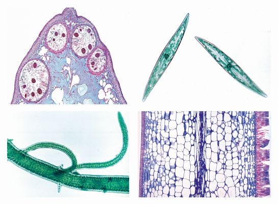 Mikropräparate in Serie - Lebensraum Meerwasser, 15 Präparate mit Begleittexen