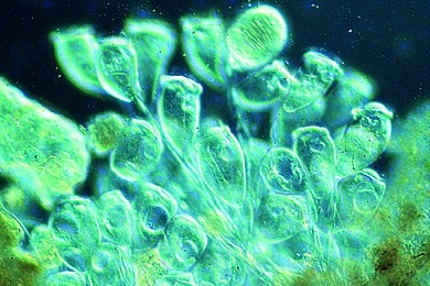 Mikropräparat - Marine Glockentierchen-Kolonie