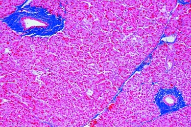 Mikropräparat - Bauchspeicheldrüse (Pankreas) vom Schwein, quer, mit Langerhansschen Inseln