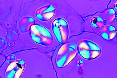 Mikropräparat - Stärkekörner, Mischpräparat von vielen Stärkesorten
