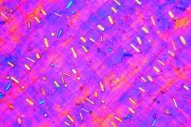 Mikropräparat - Kalziumoxalatkristalle in der trockenen Zwiebelschale, total