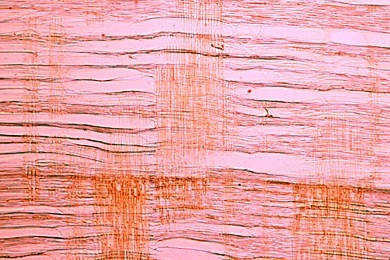 Mikropräparat - Holzzellen der Linde (Tilia), isoliert