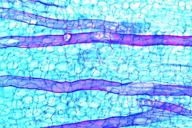 Mikropräparat - Milchröhren (ungegliedert) im Stamm der Wolfsmilch (Euphorbia), längs