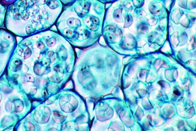 Mikropräparat - Wurzelknöllchen vom Scharbockskraut (Ranunculus ficaria), quer. Bildung von Speicherstärke im Herbst