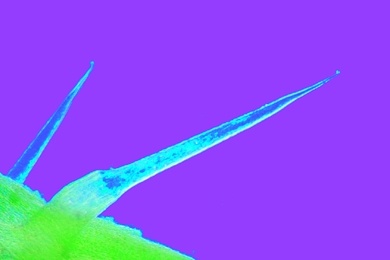 Mikropräparat - Brennhaare der Brennessel (Urtica), total