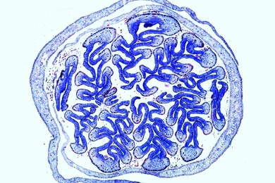 Mikropräparat - Blattknospe der Roßkastanie (Aesculus), quer, mit Knospenschuppen, Kolleteren, und gefalteten Blättern