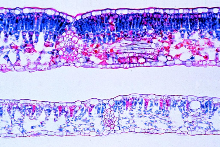 Mikropräparat - Sonnen- und Schattenblatt der Buche (Fagus)