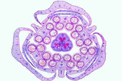 Mikropräparat - Monokotyle und dikotyle Blütenknospe, quer, Lilie (Lilium) und Hahnenfuß (Ranunculus repens), Blütendiagramme