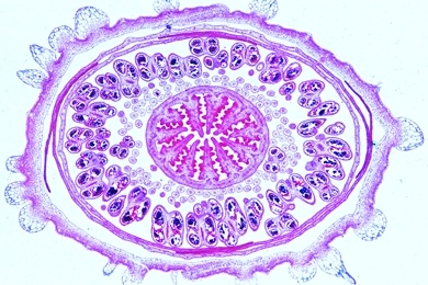 Mikropräparat - Blüte vom Mohn (Papaver), quer, Parietale Plazentation