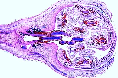 Mikropräparat - Blüte des Apfels (Pirus malus), längs, Unterständiger Fruchtknoten