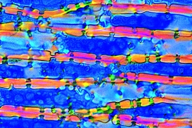Mikropräparat - Samen der Dattelpalme (Phoenix dactylifera), quer. Reservezellulose