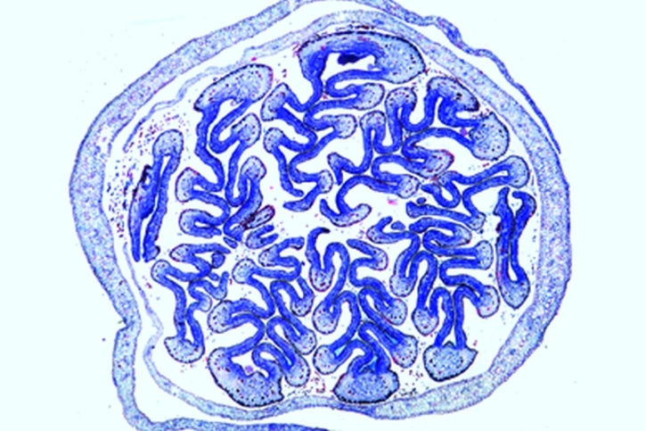 Mikropräparat - Roßkastanie, (Aesculus), Blattknospe mit Deckschuppen, quer. Winterfeste Ruheknospe