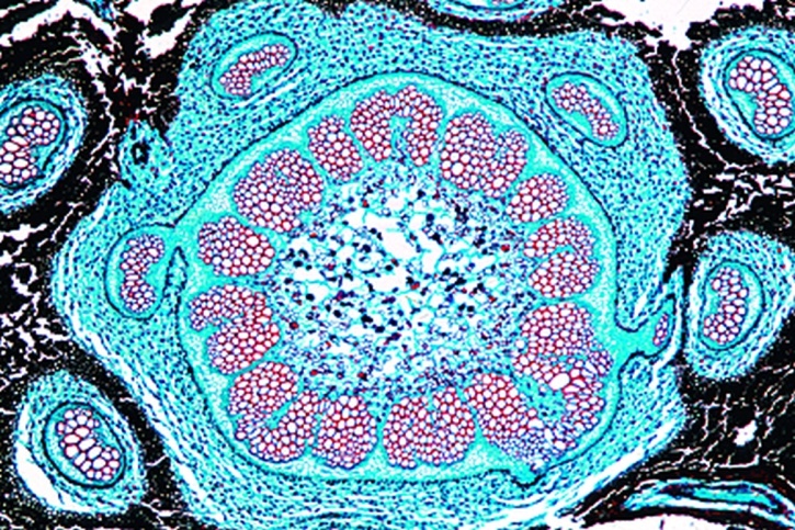 Mikropräparat - Rhizom vom Farn, Erdsproß quer