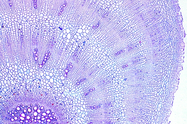 Mikropräparat - Rote Rübe (Beta), überirdische Sproßknolle, quer