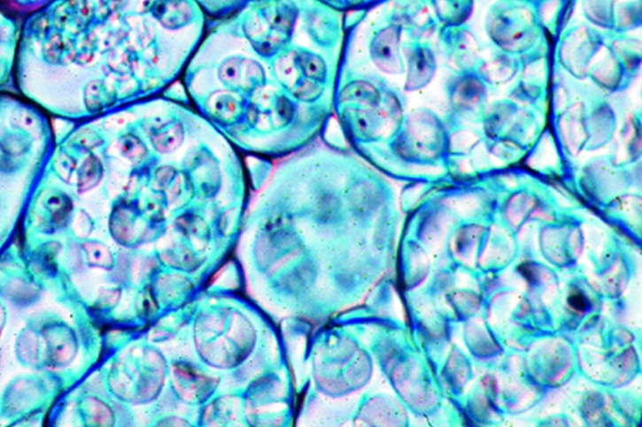 Mikropräparat - Ranunculus ficaria, Wurzelknöllchen, quer