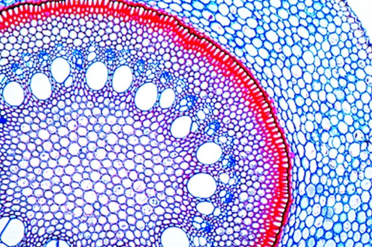 Mikropräparat - Liane, Wurzel, quer