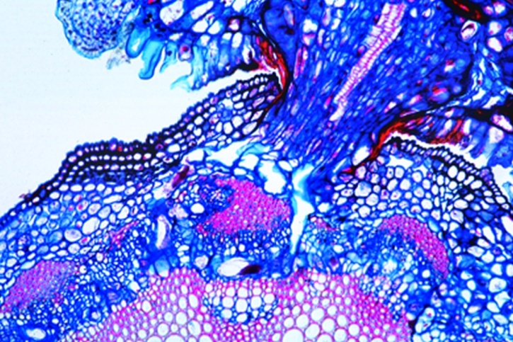 Mikropräparat - Kleeseide, (Cuscuta), Schmarotzerwurzel mit Haustorien, quer