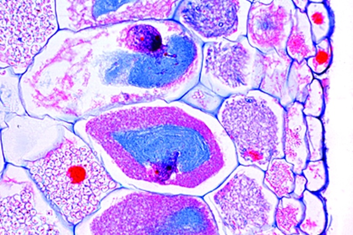 Mikropräparat - Orchidee, Wurzel mit Mykorrhiza, quer