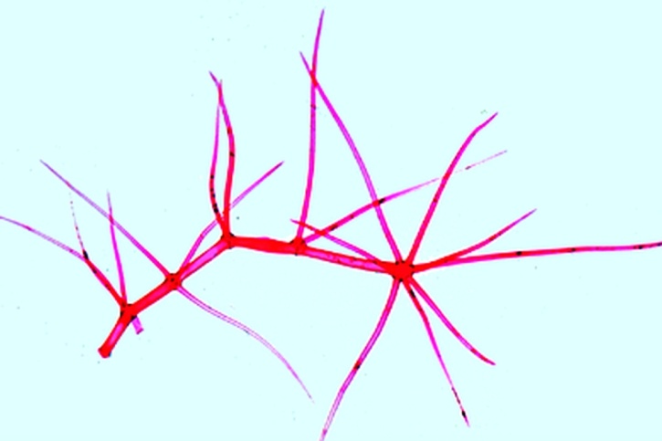 Mikropräparat - Königskerze (Verbascum), Blatt mit verzweigten Haaren, quer