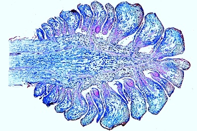 Mikropräparat - Pinus, Kiefer, junger weiblicher Blütenzapfen, längs