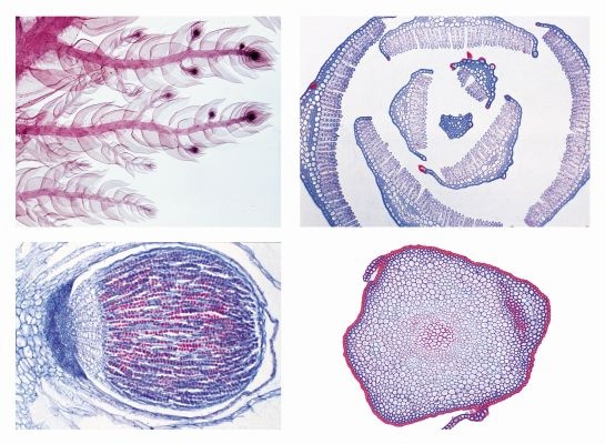 Mikropräparate in Serie - Moospflanzen (Bryophyta), 15 Präparate mit Begleittext