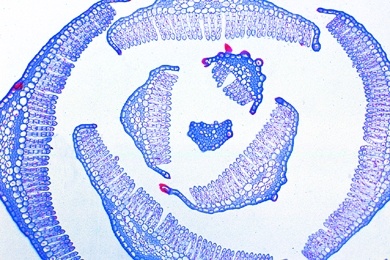 Mikropräparat - Polytrichum, Haarmoos, Blätter, quer, Laubmoose (Musci)