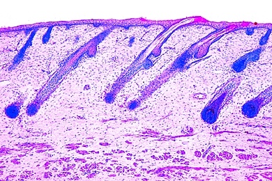 Mikropräparat - Haare vom Säugling