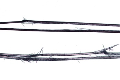 Mikropräparat - Gespaltene Haarspitzen