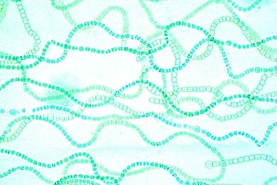 Mikropräparat - Nostoc, Gallertalge, Schnitt durch Kolonie mit Hormogonien, Blaugrüne Algen (Cyanophyceae)