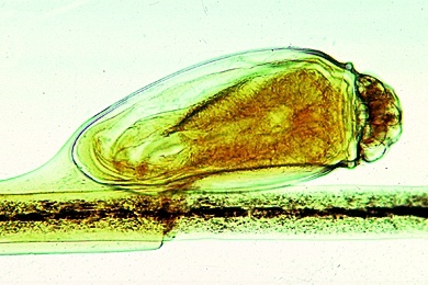 Mikropräparat - Läuseeier (Nissen) am Haar, total