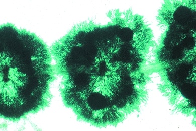Mikropräparat - Batrachospermum, Froschlaichalge, Süßwasser-Rotalge, total, Rotalgen (Rhodophyceae)