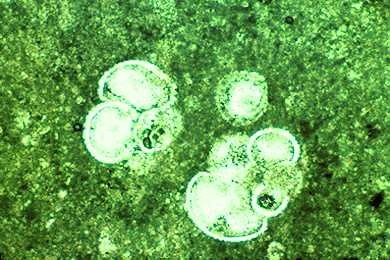 Kalkstein, Gesteinsdünnschliff Dauerpräparat