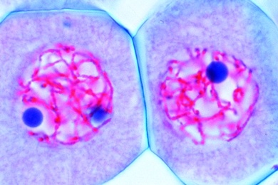 Mikropräparat - Lilie, Pachytän. Fertige Chromatidentetraden (Gemini)